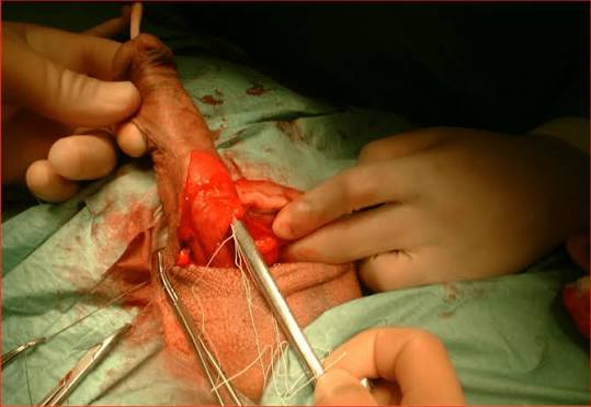 Source surgery image